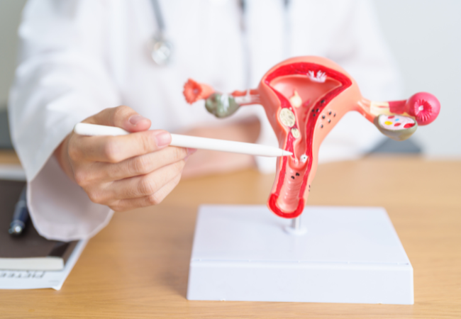 Acupuncture for Treating Fertility Acupuncture for Treating Fertility