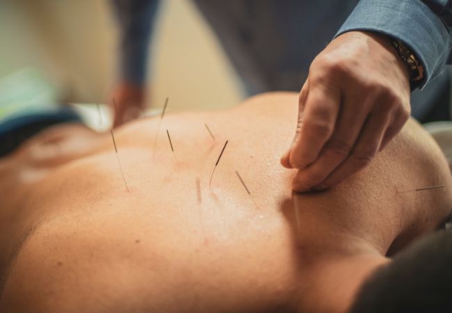 How Acupuncture Can Help with Skin Disorders