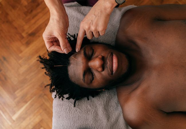 How Acupuncture Can Help With Skin Disorders