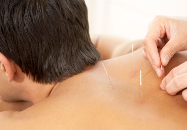 Acupuncture for Men's Health Acupuncture for Treating Fertility