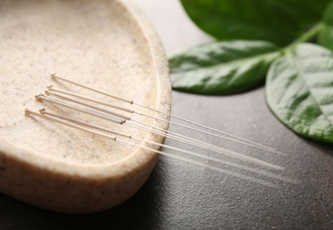 How Does Acupuncture Work for Kids How Acupuncture Can Support Children’s Health Naturally