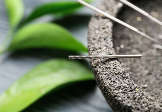 How Is Pediatric Acupuncture Different Is Acupuncture Safe for Kids? What Parents Should Know