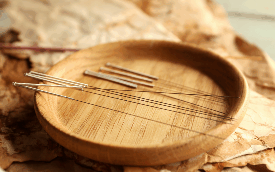 How Acupuncture Can Help a Person’s Cardiovascular System