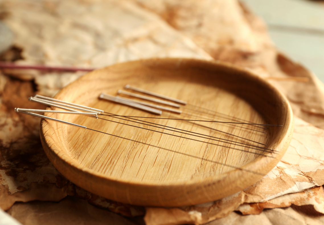 2 How Acupuncture Can Help a Person’s Cardiovascular System