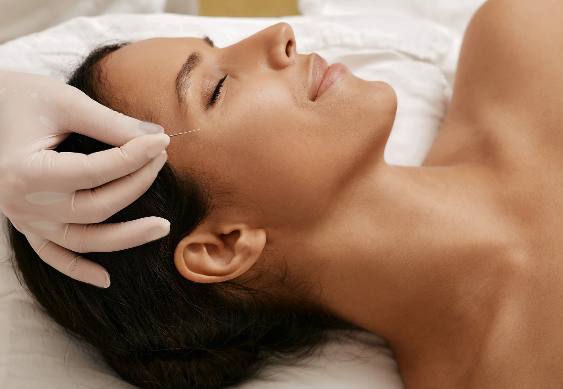 Facial Acupuncture in Boston with North End Acupuncture 