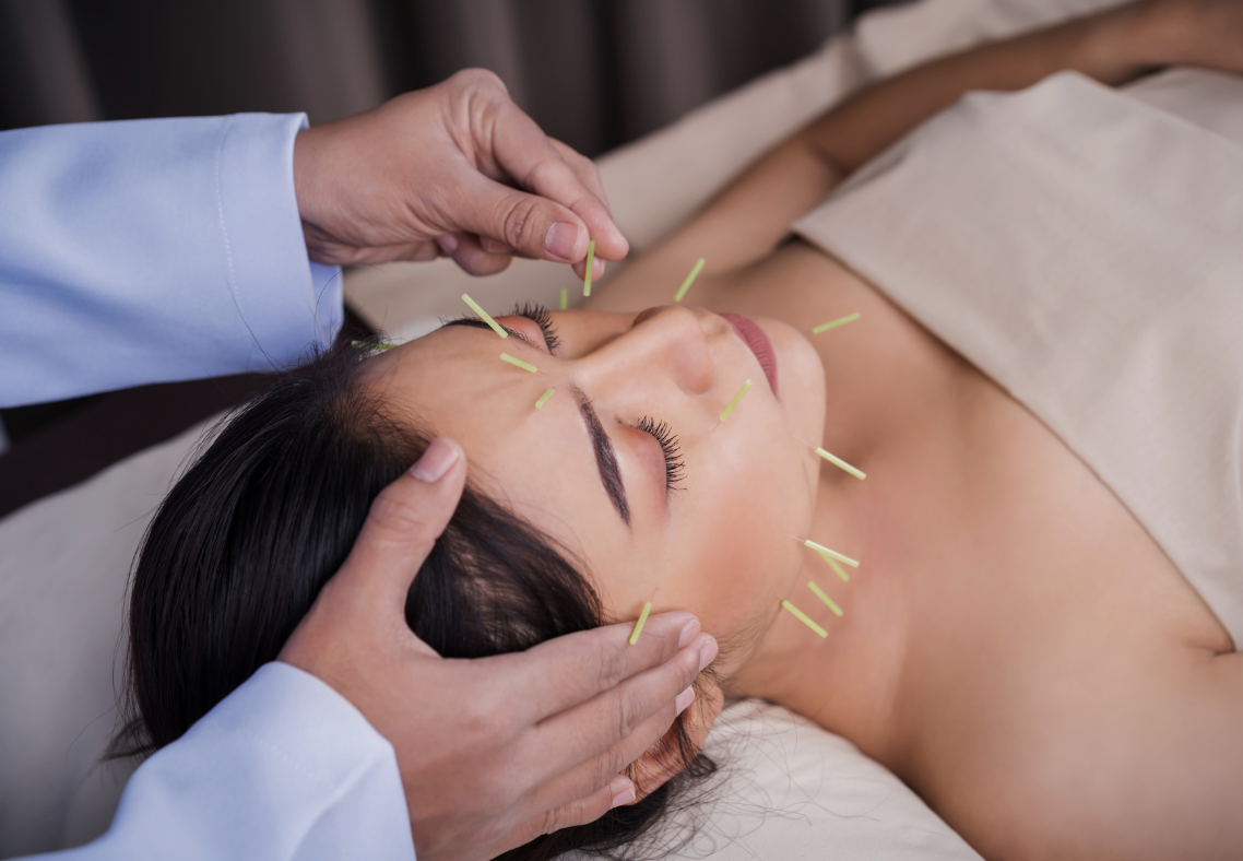 Microneedling in Boston