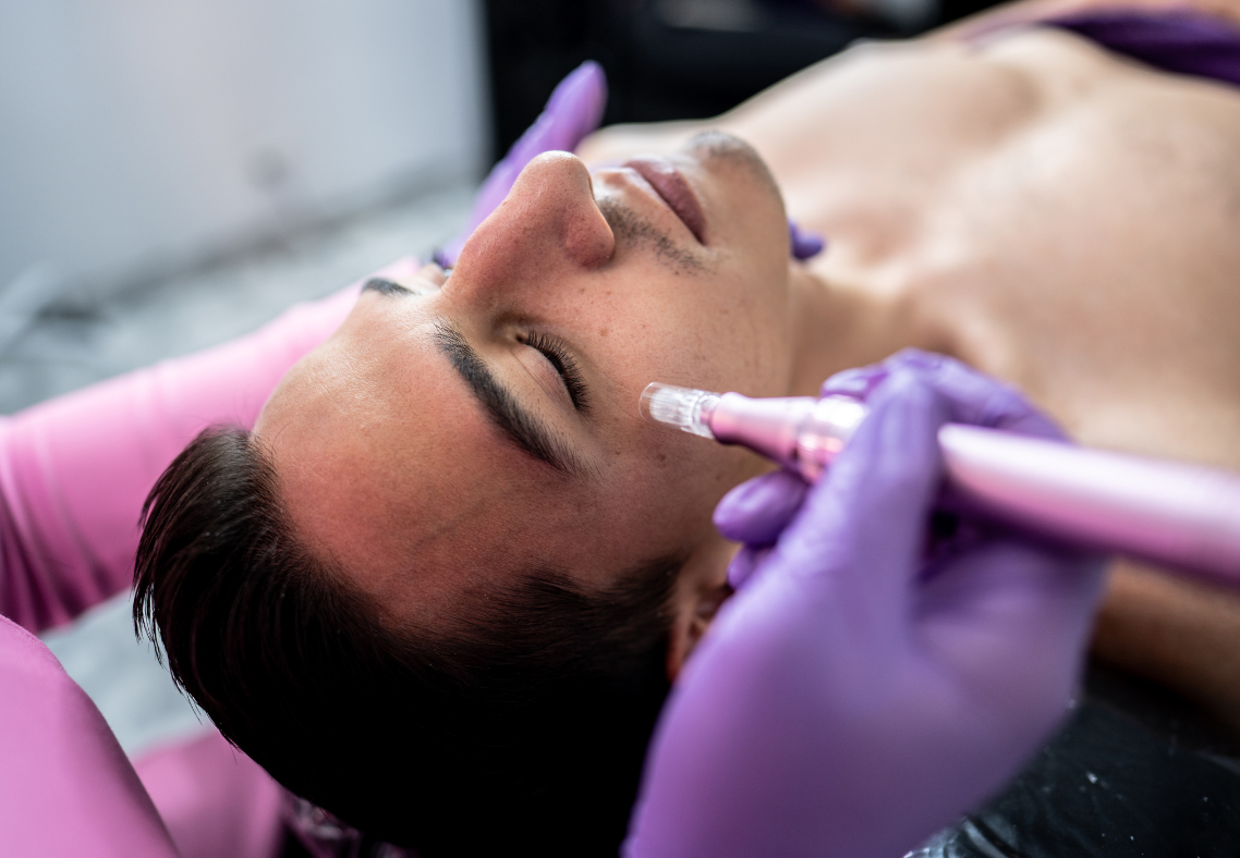 Facial Acupuncture in Boston with North End Acupuncture 