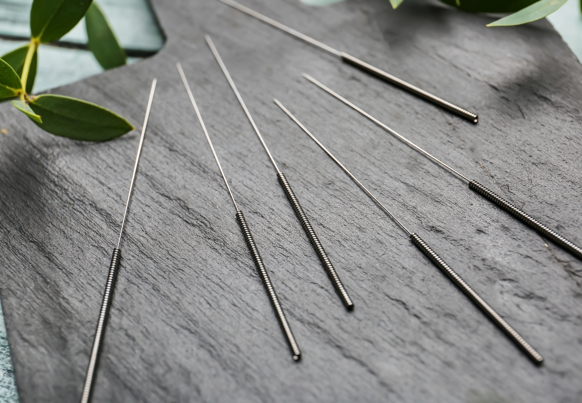 Facial Acupuncture in Boston with North End Acupuncture 