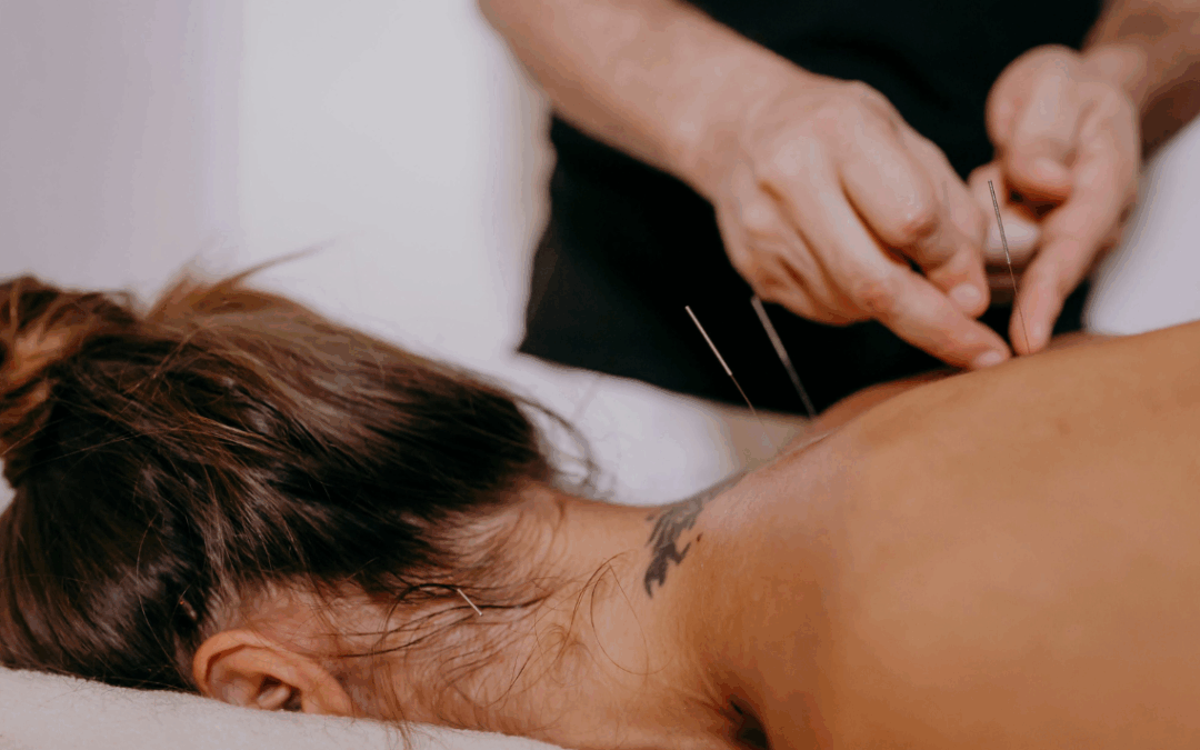 Acupuncture For Low Energy | How We Can Help Treat It