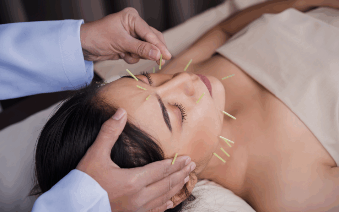 The Difference Between Facials And Cosmetic Acupuncture