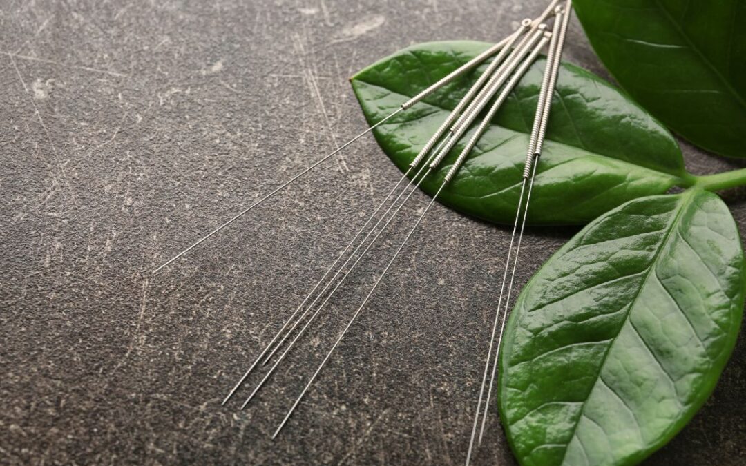Acupuncture for Stress and Anxiety in Boston: A Case Study on Burnout, Sleep Disruption, and Nervous System Regulation