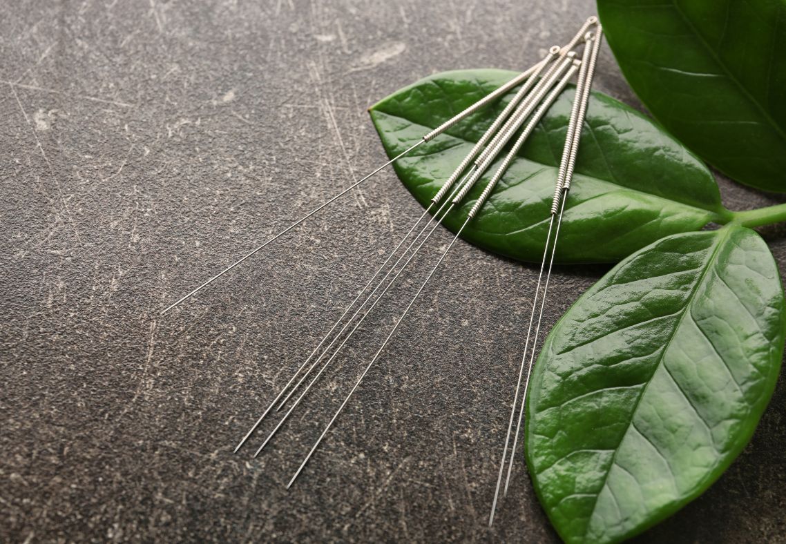 A Case Study on Burnout, Sleep Disruption, and Nervous System Regulation Acupuncture for Stress and Anxiety in Boston: A Case Study on Burnout, Sleep Disruption, and Nervous System Regulation