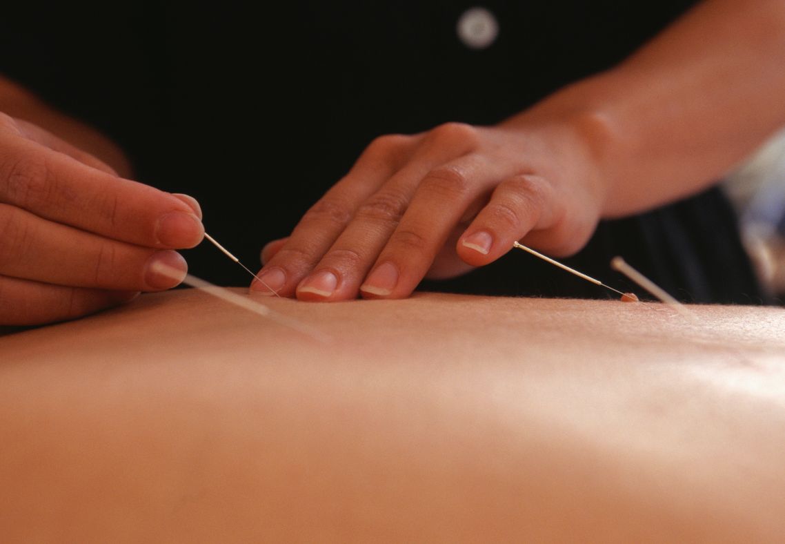 A Case Study on Chronic Tension, Inflammation, and Mobility Recovery Acupuncture for Low Back Pain and Sciatica in Boston: A Case Study on Chronic Tension, Inflammation, and Mobility Recovery
