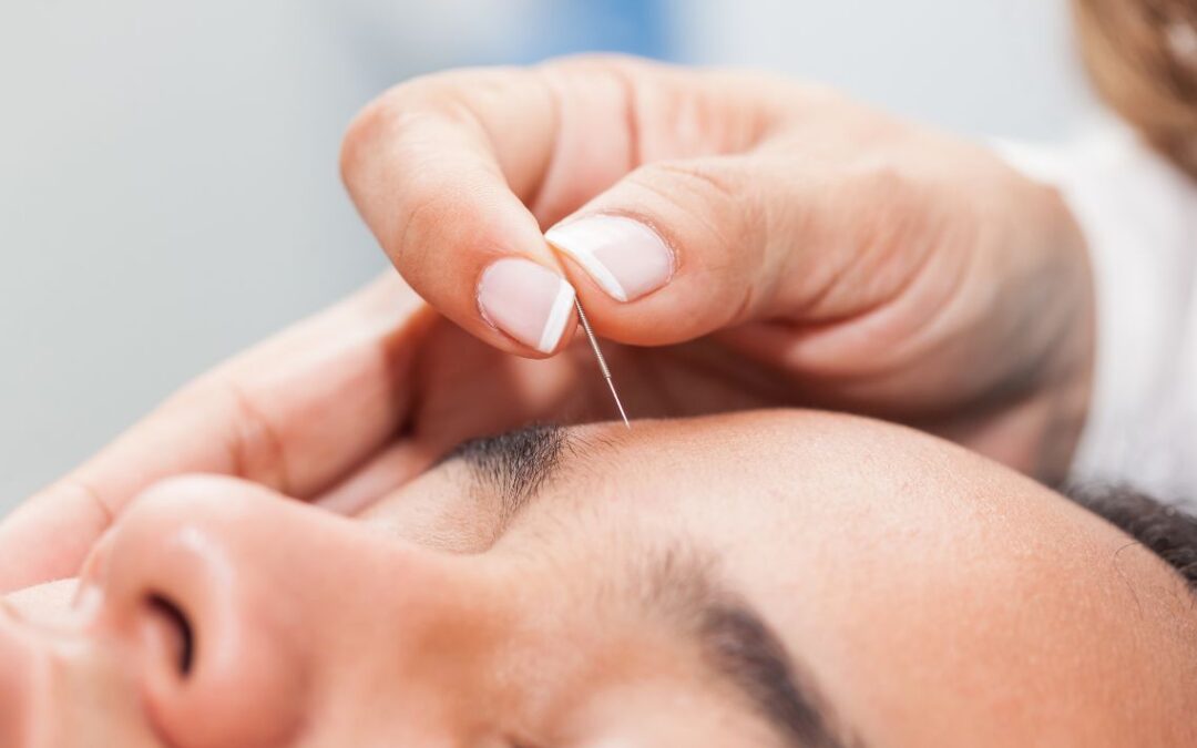Facial Acupuncture in Boston: A Case Study on Skin Health, Jaw Tension, and Stress Related Facial Tightness