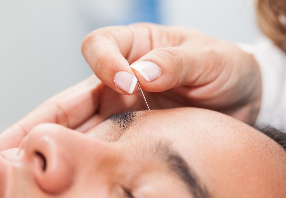 Facial Acupuncture in Boston: A Case Study on Skin Health, Jaw Tension, and Stress Related Facial Tightness
