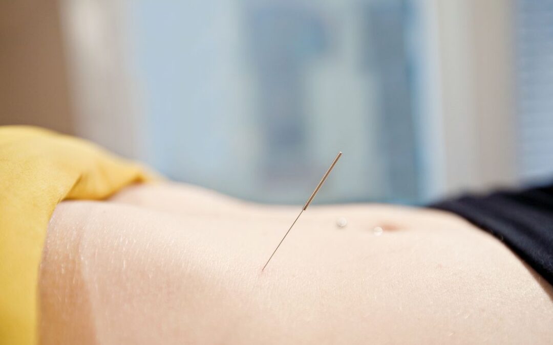 Acupuncture for Endometriosis and Fibroids: A Boston Patient’s Road to Natural Conception