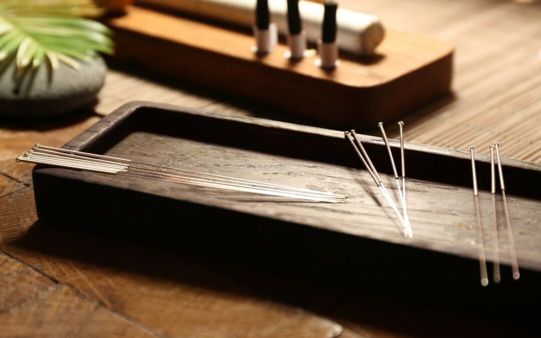 No Diagnosis, No Problem? How Acupuncture Helped a Boston Patient Beat Unexplained Infertility